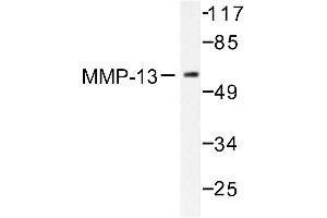Image no. 1 for anti-Matrix Metallopeptidase 13 (Collagenase 3) (MMP13) antibody (ABIN265524) (MMP13 anticorps)