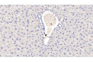 Detection of CRP in Mouse Liver Tissue using Polyclonal Antibody to C Reactive Protein (CRP) (CRP anticorps  (AA 20-225))