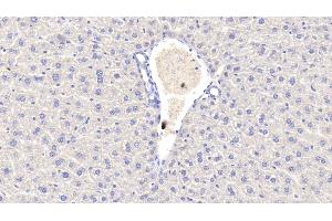 Detection of CRP in Mouse Liver Tissue using Polyclonal Antibody to C Reactive Protein (CRP) (CRP anticorps  (AA 20-225))