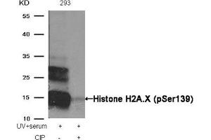 Western blot analysis of extracts from 293 cells, treated with UV+serum or calf intestinal phosphatase (CIP), using Histone H2A. (H2AFX anticorps  (pSer139))