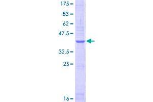 Image no. 1 for Natriuretic Peptide Receptor A/guanylate Cyclase A (Atrionatriuretic Peptide Receptor A) (NPR1) (AA 147-247) protein (GST tag) (ABIN1312893)