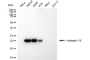 Western blotting analysis using interleukin 18 antibody (ABIN7799103).
