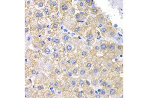 Immunohistochemistry (IHC) image for anti-V-Crk Sarcoma Virus CT10 Oncogene Homolog (Avian) (CRK) (AA 1-304) antibody (ABIN3015531) (Crk anticorps  (AA 1-304))