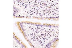 Immunohistochemistry of paraffin embedded mouse duodenum using ASBT (ABIN7075648) at dilution of 1:1500 (400x lens)