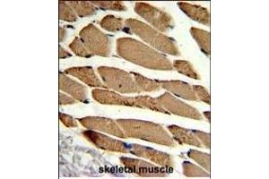 Formalin-fixed and paraffin-embedded human skeletal muscle reacted with ACTR2 Antibody (Center), which was peroxidase-conjugated to the secondary antibody, followed by DAB staining. (ACTR2 anticorps  (AA 191-219))