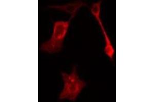 ABIN6277627 staining HeLa cells by IF/ICC. (Plakophilin 2 anticorps  (N-Term))