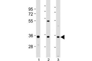 Western blot testing of 1) human 293T/17, 2) mouse brain and 3) human SH-SY5Y cell lysate with NAT8L antibody at 1:2000. (NAT8L anticorps  (AA 59-93))