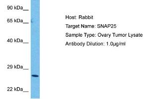 Host:  Rabbit  Target Name:  SNAP25  Sample Tissue:  Human Ovary Tumor  Antibody Dilution:  1ug/ml