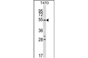 Western blot analysis in T47D cell line lysates (35ug/lane).