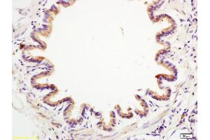 Formalin-fixed and paraffin embedded rat lung labeled with Anti-Anterior Gradient 2 Polyclonal Antibody, Unconjugated (ABIN710021) at 1:200 followed by conjugation to the secondary antibody and DAB staining. (AGR2 anticorps  (AA 51-150))