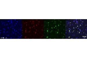 Immunohistochemistry (IHC) image for anti-Oligodendrocytic Myelin Paranodal and Inner Loop Protein (OPALIN) antibody (ABIN7456340) (OPALIN anticorps)