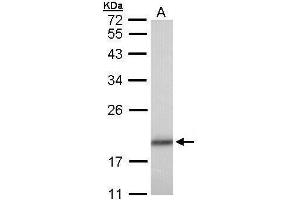 WB Image Sample (30 ug of whole cell lysate) A: A431, 12% SDS PAGE antibody diluted at 1:1000