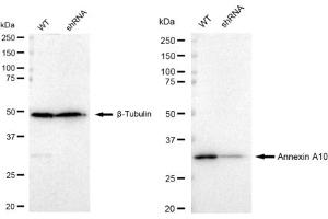 Western blotting analysis using Annexin A10 antibody (ABIN7797615). (Recombinant Annexin a10 anticorps)