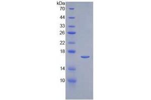 SDS-PAGE of Protein Standard from the Kit  (Highly purified E.