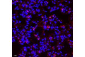 Immunofluorescence of paraffin embedded mouse lung using Aldh4a1 (ABIN7073000) at dilution of 1: 400 (400x lens)
