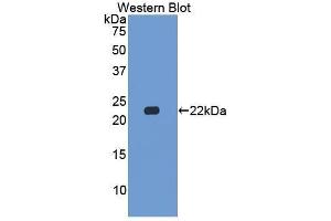 Western Blotting (WB) image for anti-Casein beta (CSN2) (AA 41-198) antibody (ABIN1867412) (CSN2 anticorps  (AA 41-198))