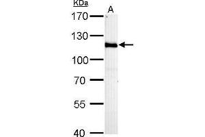WB Image HGS antibody [C2C3], C-term detects HGS protein by Western blot analysis. (HGS anticorps  (C-Term))