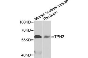 Western blot analysis of extracts of various cell lines, using TPH2 antibody. (Tryptophan Hydroxylase 2 anticorps)