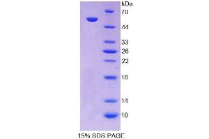 SDS-PAGE analysis of Human SCNN1a Protein. (SCNN1A Protéine)