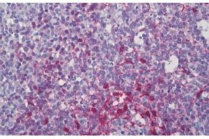 Anti-PDLIM1 antibody IHC staining of human tonsil. (PDLIM1 anticorps  (AA 61-110))