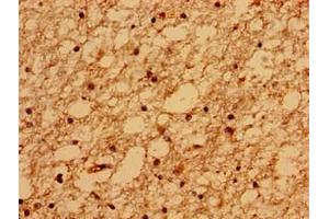 Immunohistochemistry of paraffin-embedded human brain tissue using ABIN7159092 at dilution of 1:100 (TMEM67 anticorps  (AA 241-500))