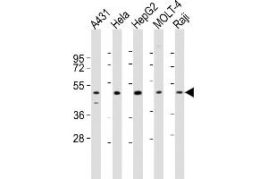 All lanes : Anti-CYP24A1 Antibody (N-term) at 1:2000 dilution Lane 1: A431 whole cell lysates Lane 2: Hela whole cell lysates Lane 3: HepG2 whole cell lysates Lane 4: MOLT-4 whole cell lysates Lane 5: Raji whole cell lysates Lysates/proteins at 20 μg per lane.
