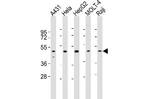 All lanes : Anti-CYP24A1 Antibody (N-term) at 1:2000 dilution Lane 1: A431 whole cell lysates Lane 2: Hela whole cell lysates Lane 3: HepG2 whole cell lysates Lane 4: MOLT-4 whole cell lysates Lane 5: Raji whole cell lysates Lysates/proteins at 20 μg per lane. (CYP24A1 anticorps  (N-Term))