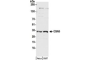 Western Blotting (WB) image for anti-COP9 Constitutive Photomorphogenic Homolog Subunit 5 (Arabidopsis) (COPS5) (AA 175-225) antibody (ABIN7449381)
