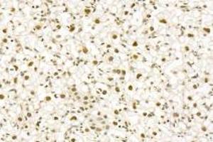 Immunohistochemistry analysis of paraffin-embedded rat duodenum using,PNN (ABIN7075083) at dilution of 1: 1200