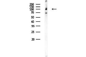 anti-Glutamate Receptor, Metabotropic 3 (GRM3) (C-Term) antibody