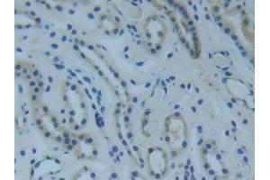 Detection of Raftlin in Human Kidney Tissue using Polyclonal Antibody to Raft Linking Protein (Raftlin)