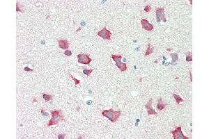 Anti-RPS6KB2 / S6K2 antibody IHC staining of human brain, cortex.