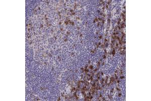 Immunohistochemical staining (Formalin-fixed paraffin-embedded sections) of human lymph node with SLAMF7 polyclonal antibody  shows strong cytoplasmic positivity in germinal center cells and non-germinal center cells. (SLAMF7 anticorps  (AA 253-323))