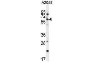 CCDC148 Antibody (Center) western blot analysis in A2058 cell line lysates (35µg/lane).