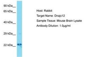 Image no. 1 for anti-DnaJ (Hsp40) Homolog, Subfamily C, Member 12 (DNAJC12) (AA 31-80) antibody (ABIN6750387) (DNAJC12 anticorps  (AA 31-80))