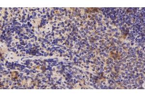 Detection of ADRM1 in Rat Spleen Tissue using Polyclonal Antibody to Adhesion Regulating Molecule 1 (ADRM1) (ADRM1 anticorps  (AA 2-407))