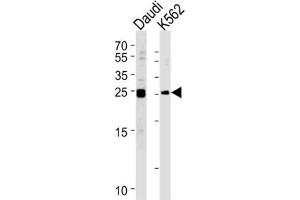Western Blotting (WB) image for anti-MOB Kinase Activator 1B (MOB1B) antibody (ABIN3002948) (MOBKL1A anticorps)