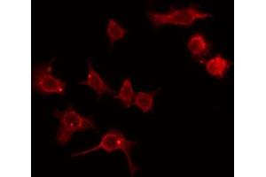 ABIN6274411 staining Hela by IF/ICC. (ADCK2 anticorps  (Internal Region))