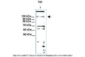 Lanes:  30ug NIH3T3 cell lysate Primary Antibody Dilution:  1:1000 Secondary Antibody:  Anti-rabbit HRP Secondary Antibody Dilution:  1: 5000 Gene Name:  Ttf1 Submitted by:  Thomas Moss (TTF1 anticorps  (N-Term))