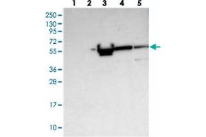 Western blot analysis of Lane 1: RT-4, Lane 2: U-251 MG, Lane 3: Human Plasma, Lane 4: Liver, Lane 5: Tonsil with ALKBH8 polyclonal antibody  at 1:250-1:500 dilution. (ALKBH8 anticorps)