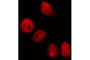 ABIN6269161 staining HeLa by IF/ICC. (CREB1 anticorps  (Internal Region))