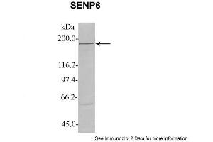 Sample Type: 1. (SENP6 anticorps  (C-Term))