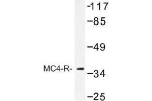 Image no. 1 for anti-Melanocortin 4 Receptor (MC4R) antibody (ABIN317754) (MC4R anticorps)
