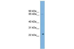 WB Suggested Anti-CALCOCO1 Antibody Titration: 0. (CALCOCO1 anticorps  (N-Term))