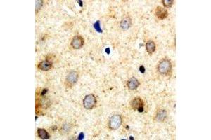 Immunohistochemical analysis of SAR1B staining in human brain formalin fixed paraffin embedded tissue section.