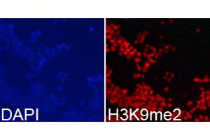 Immunofluorescence analysis of 293T cells using DiMethyl-Histone H3-K9 antibody.