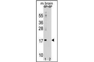 Western blot analysis using LC3 Antibody  in Mouse brain tissue lysates (35ug/lane).