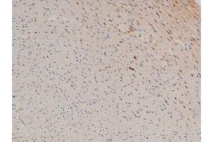 ABIN6267554 at 1/100 staining rat heart tissue sections by IHC-P.