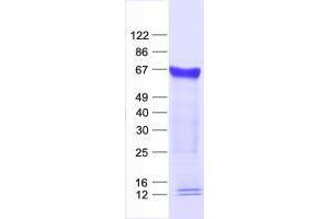 Validation with Western Blot (ZNF230 Protein (His tag))