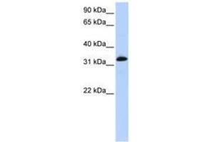 Image no. 1 for anti-Cardiac Troponin T (cTnT) (AA 72-121) antibody (ABIN6743074) (Cardiac Troponin T2 anticorps  (AA 72-121))